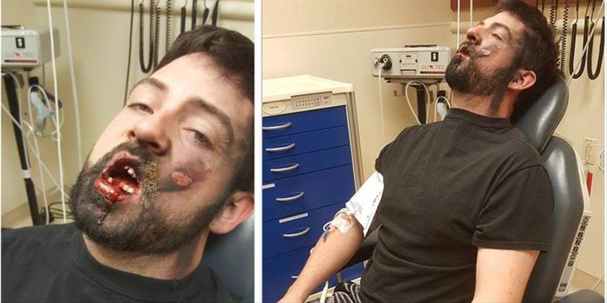 Krvavé FOTO Mužovi v ústach vybuchla e-cigareta, prišiel o sedem zubov a skoro mu zhorel dom