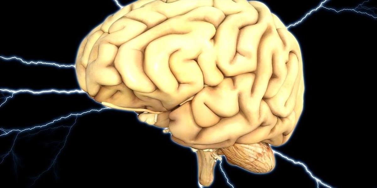 Slováci zistili, že pri mozgovej príhode môžu pomáhať proteíny