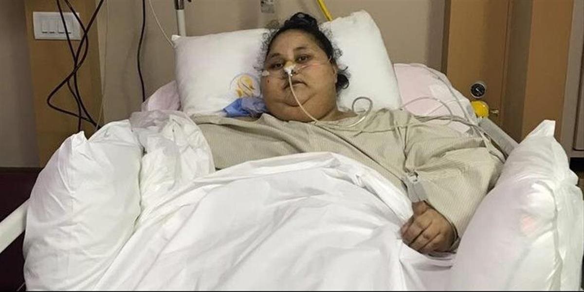 Poltonová Egypťanka podstúpila v Indii operáciu, z hmotnosti jej ubudlo 100 kíl