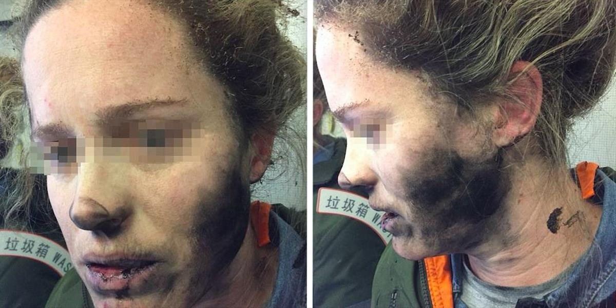 FOTO Austrálčanke explodovali na hlave slúchadlá počas letu