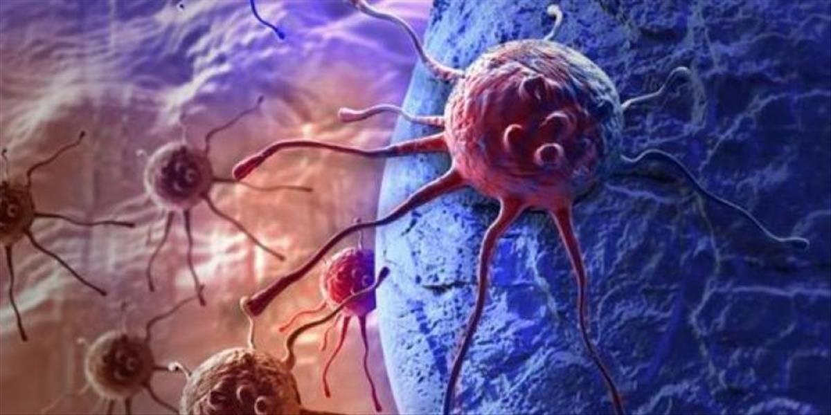 Prelomový objav v medicíne: Vedci vyvíjajú smrtiacu zbraň proti rakovine