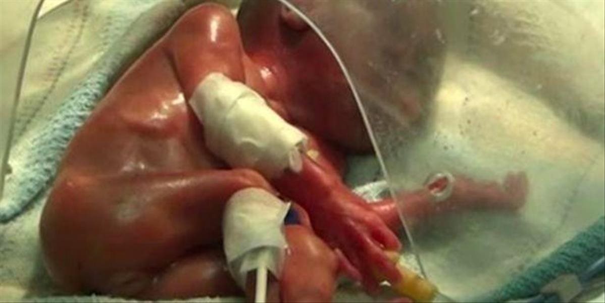 Personál nemocnice pochybil: Novorodené dieťa takmer spopolnili zaživa!