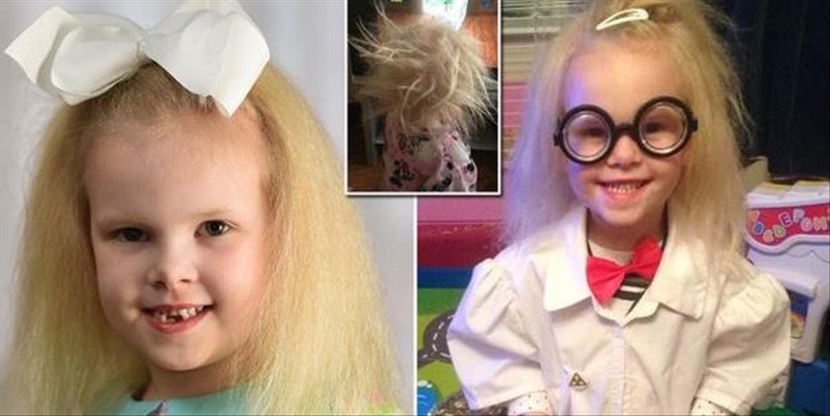 Malé dievčatko si kvôli ochoreniu nemôže ani očesať vlasy