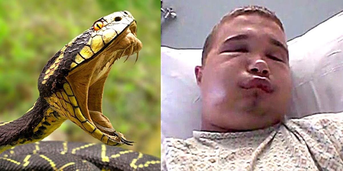 Neuveriteľné: Američan chcel pobozkať hada, skončil v nemocnici