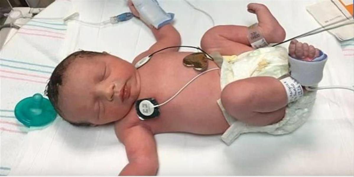 VIDEO Bábätko vyšlo z tela matky 2-krát, operovali ho ešte pred tým, ako sa narodilo