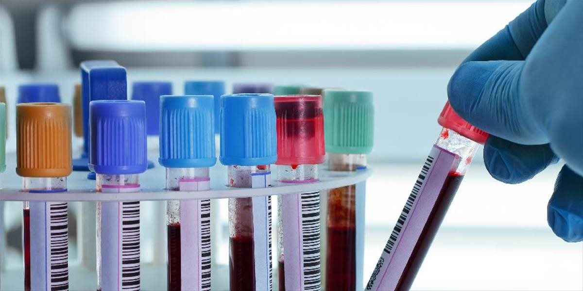 Antidopingová agentúra pozastavila akreditáciu laboratóriu v Los Angeles