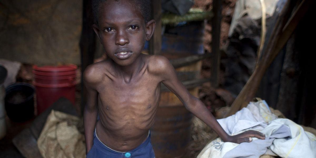 Viac ako 20-tisíc detí v Somálsku môže zomrieť od hladu