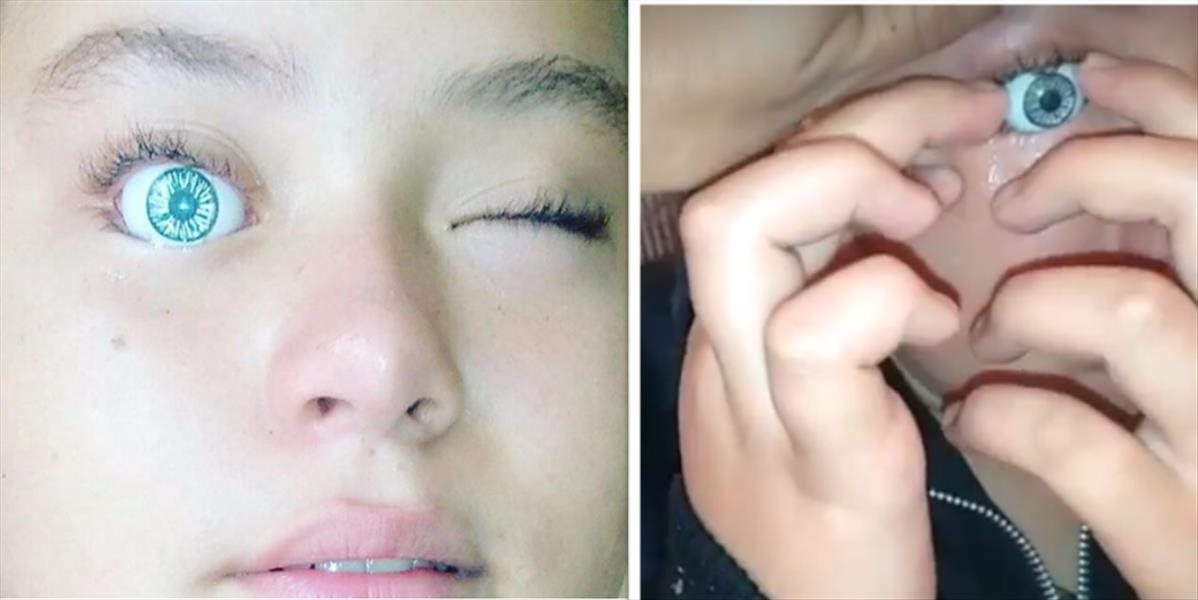 Nechutné VIDEO Dievča si buľvu zatlačilo okom z bábiky, nasledoval krik a muky