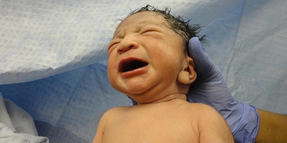 FOTO + VIDEO V Indii prišiel na svet tehotný novorodenec! Mohla za to vzácna vývojová porucha