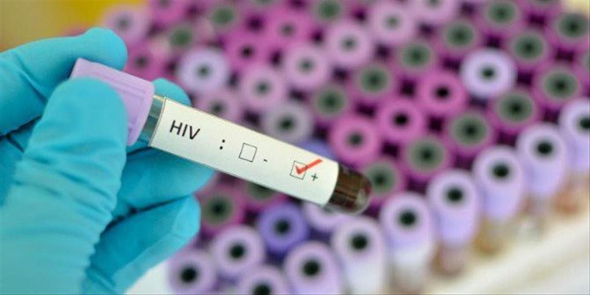 Vzrušujúci objav! Nová protilátka dokáže zničiť takmer 100% vírusu HIV, mohla by skoliť aj rakovinu