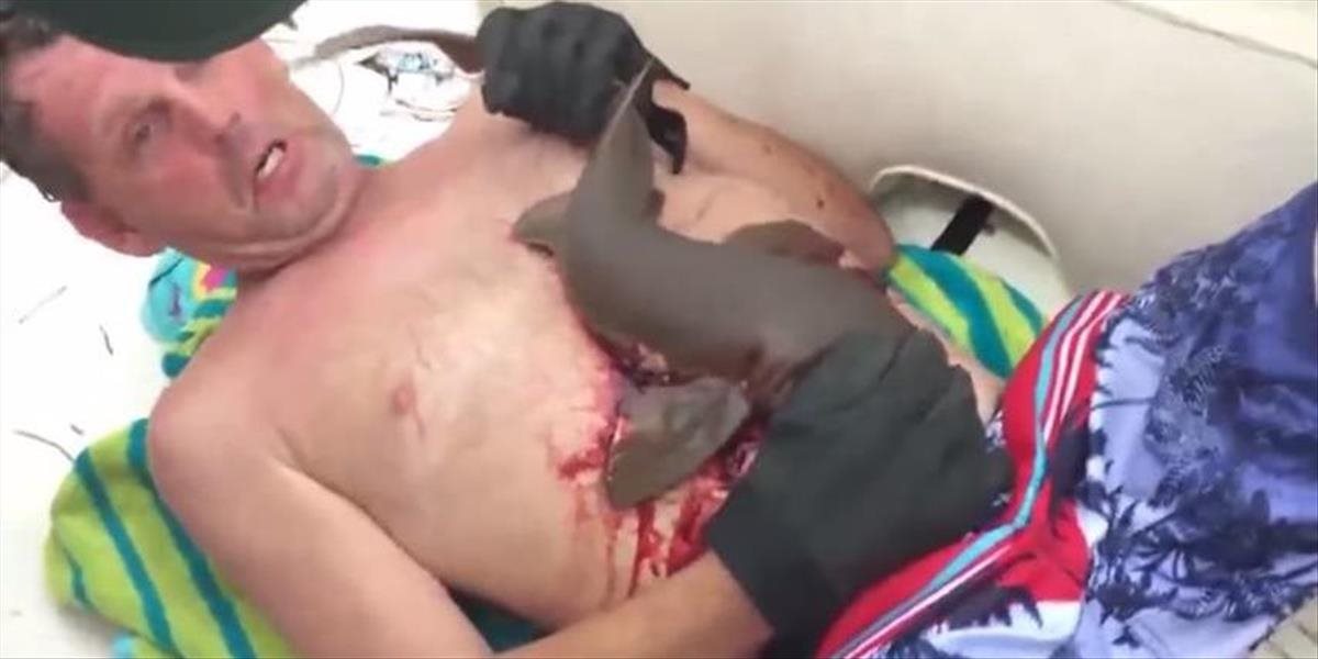 VIDEO Aj malý žralok dokáže spôsobiť veľa zloby, muž pod hladinou zažil peklo