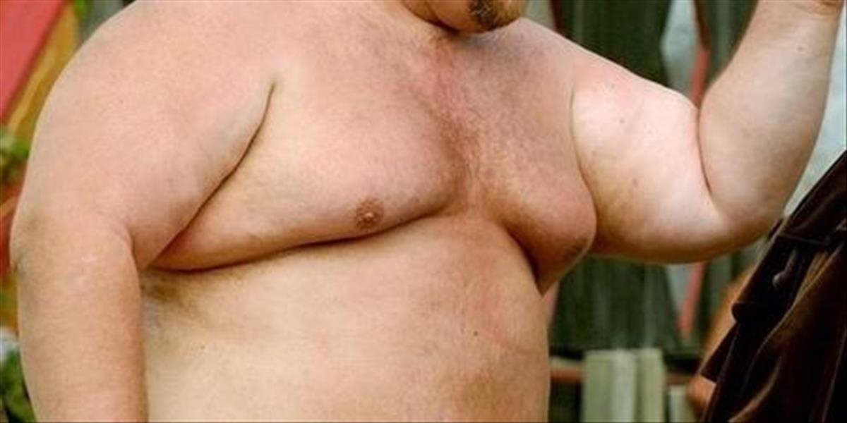 Nechutné FOTO: Čo sa skrýva pod kožou obéznych ľudí?