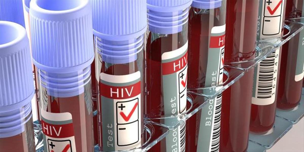 Taliansky účtovník nakazil desiatky žien vírusom HIV