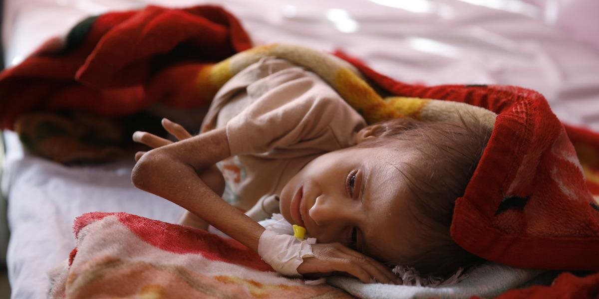 Pre hlad a choroby umiera v Jemene denne 130 detí