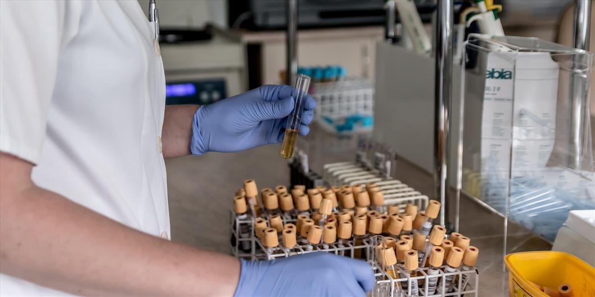 Nebezpečenstvo pneumokokových nákaz, ktoré bývajú aj smrteľné, je v zime vyššie