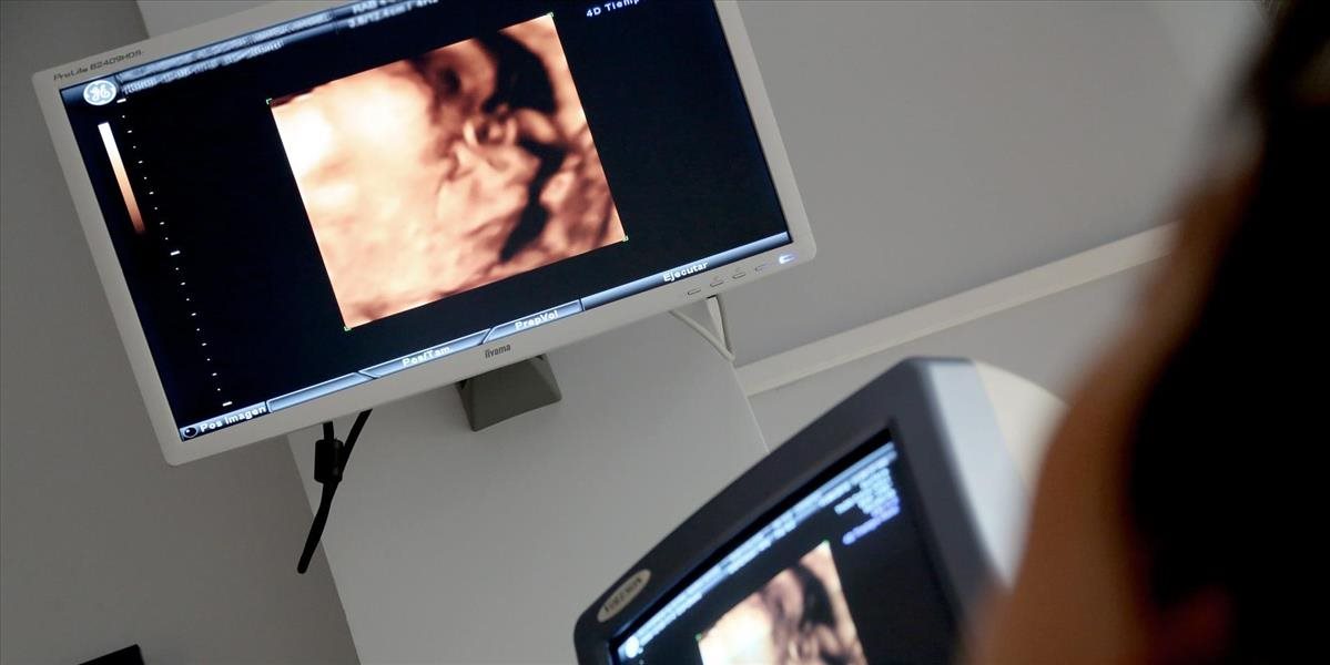 DOJEMNÉ VIDEO: Bábätko na ultrazvuku zamávalo na svojich rodičov!