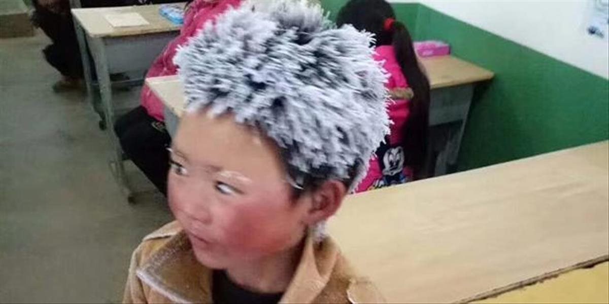 FOTO Chudobný chlapec šiel pešo do školy v ukrutnej zime, takto omrzol!