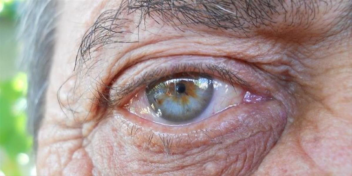 Zelený zákal môže viesť až k slepote, upozorňuje Svetový týždeň glaukómu