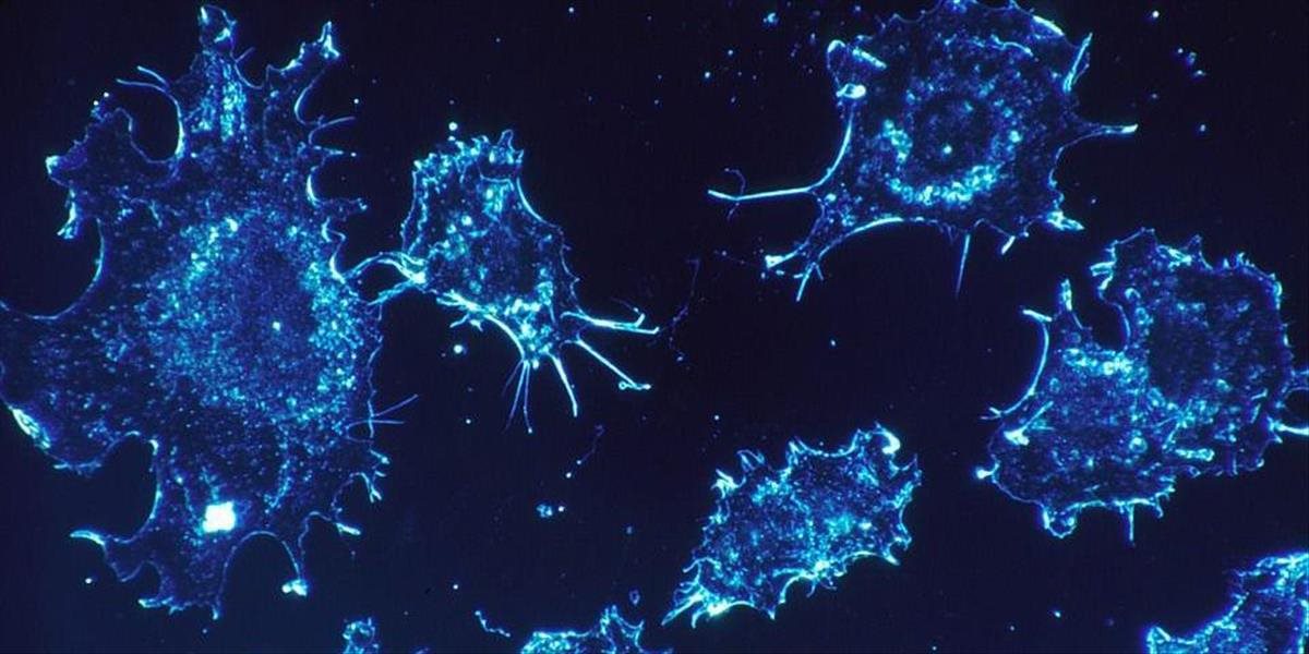 Českí a Americkí vedci objavili metódu, ako doslova vyhladovať zákerné rakovinotvorné bunky, na výskum získali milióny dolárov
