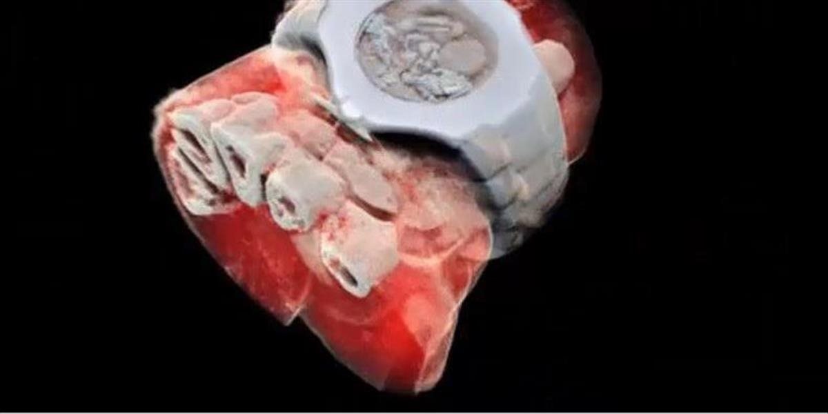 Do medicíny prichádza 3D farebný röntgen! Takto vás preskenuje