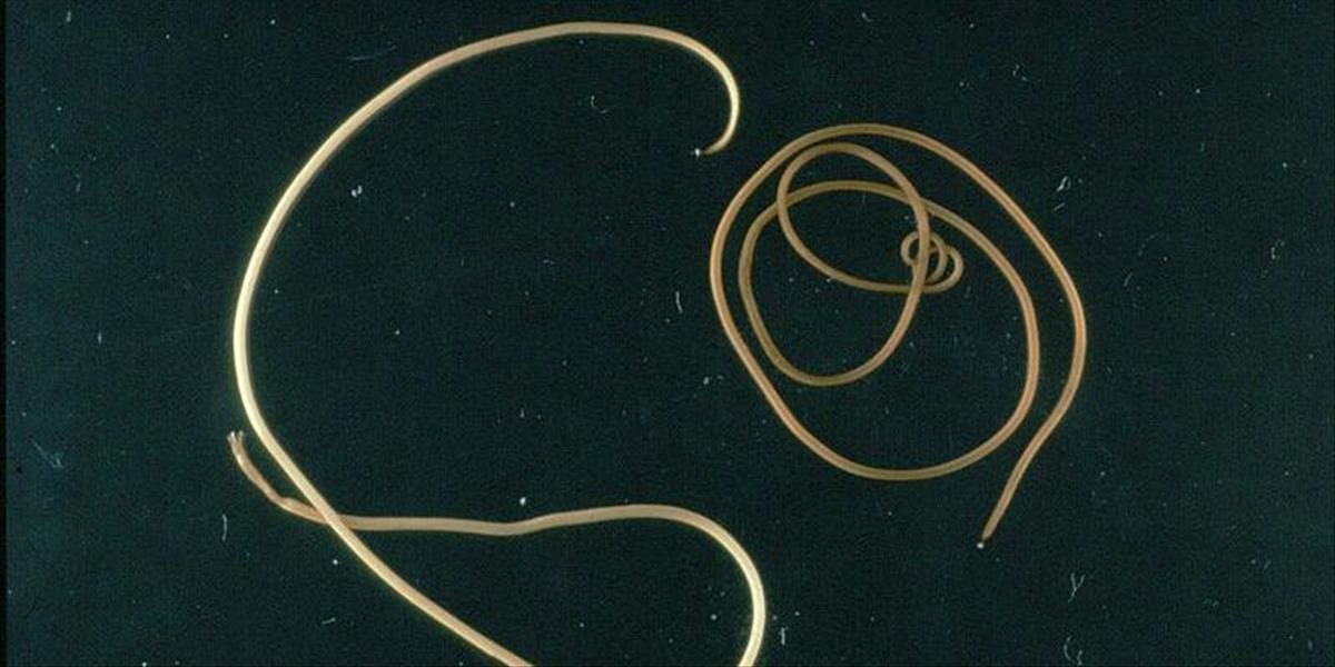 Sibír odkryl tajomstvo: Vedci tu oživili 42-tisíc rokov staré červy!