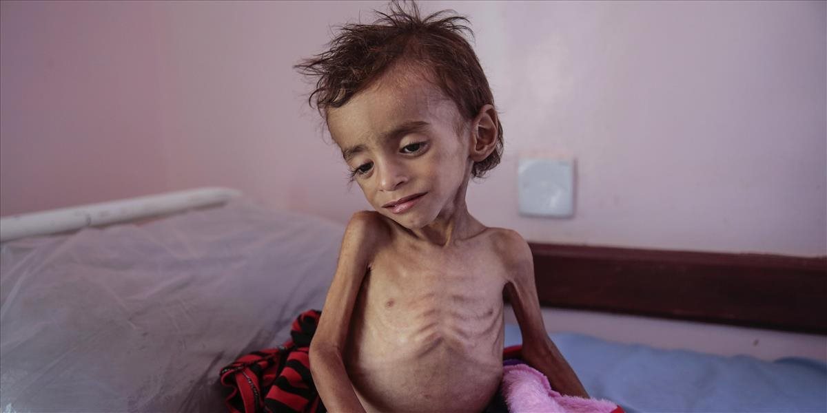 V Jemene zomrelo od hladu už zrejme 85.000 detí