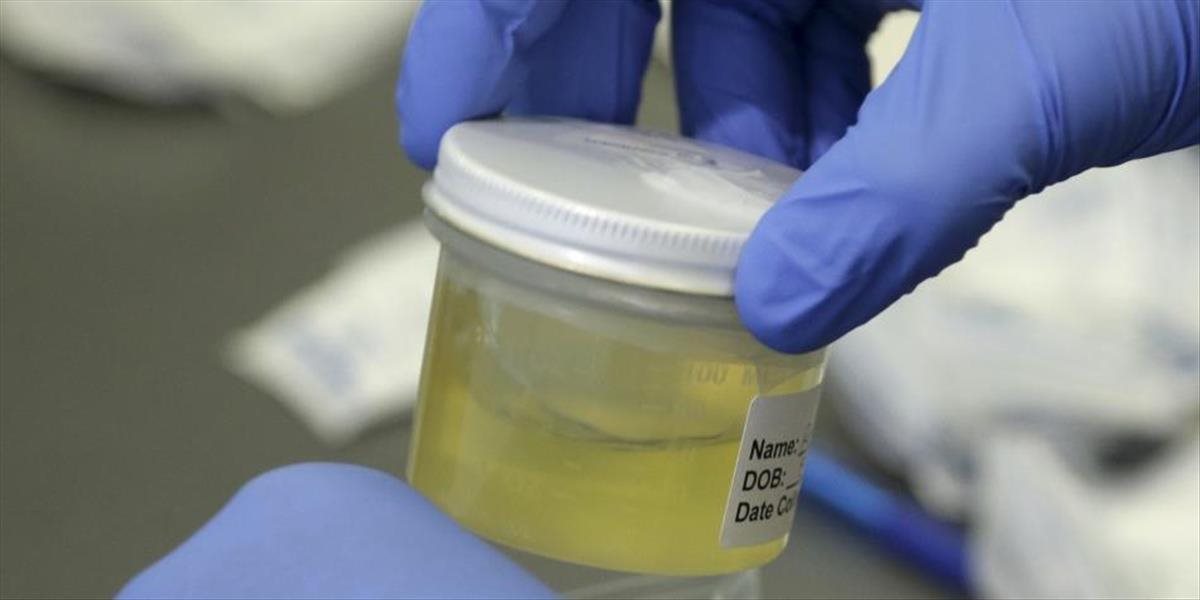 WADA už kopíruje údaje z moskovského laboratória