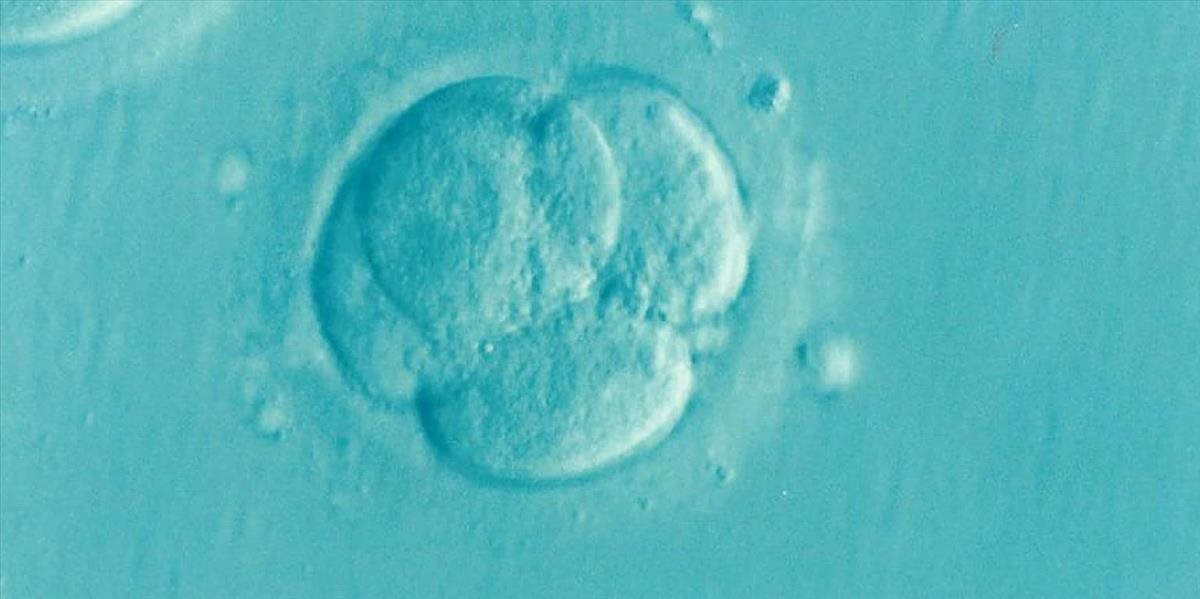 Na letisku v Bombaji zadržali Malajzijčana, ktorý mal v batožine ľudské embryo