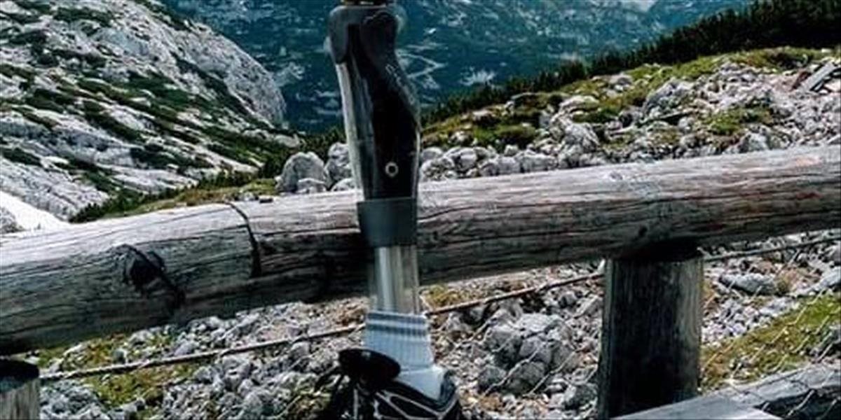 V Česku ukradli mužovi drahú protetickú nohu: Majiteľ prosí o pomoc