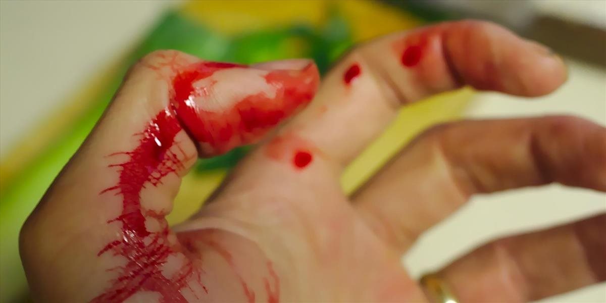 Štyria ľudia zahynuli pri útoku pacienta na psychiatrickej klinike