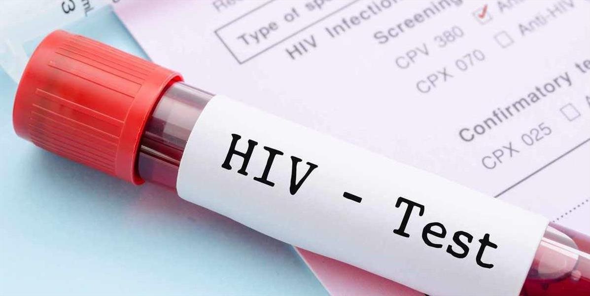 Vakcína proti HIV sa neosvedčila, odborníci sú sklamaní