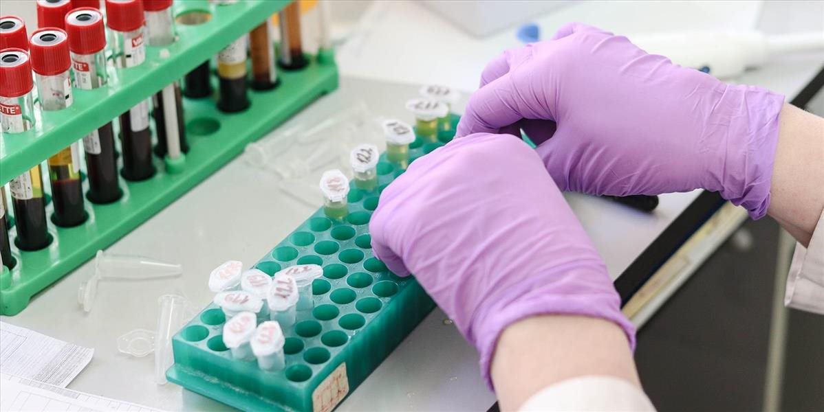 Na Slovensku už prešlo testom 143 vzoriek, koronavírus sa ani u jednej nepotvrdil