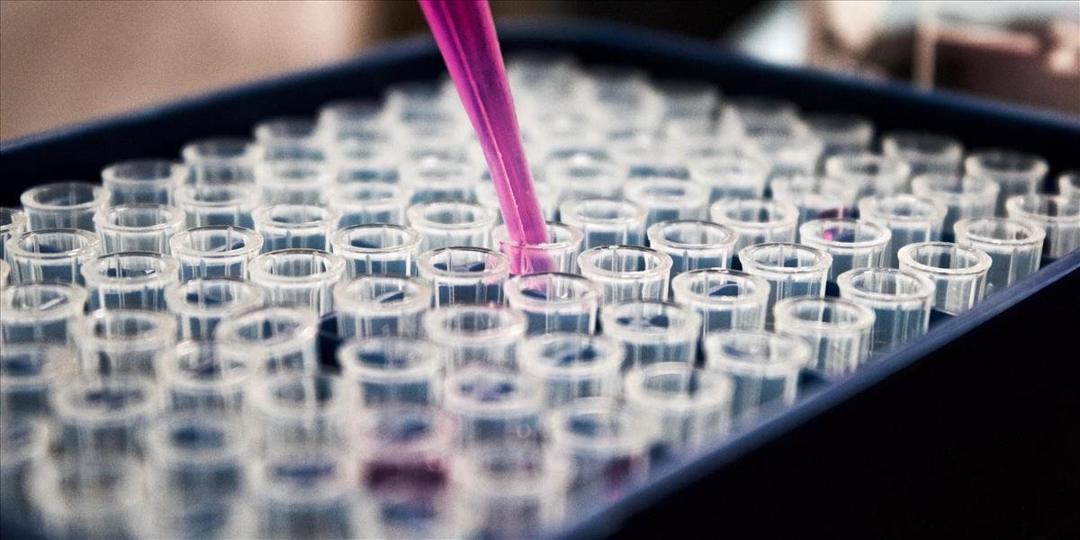 Vedci EÚ vyvinuli materiál, ktorý predíde zlyhaniam pri testoch na COVID-19