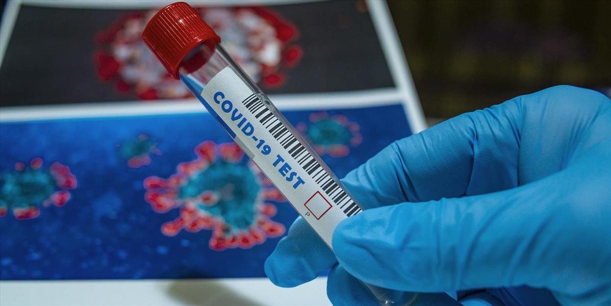 Slovensko eviduje 16 nových prípadov