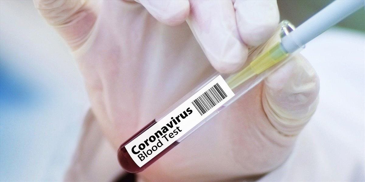 Vakcína od Pfizer dosiahla až 90% účinnosť, vráti sa už na jar všetko do normálu?