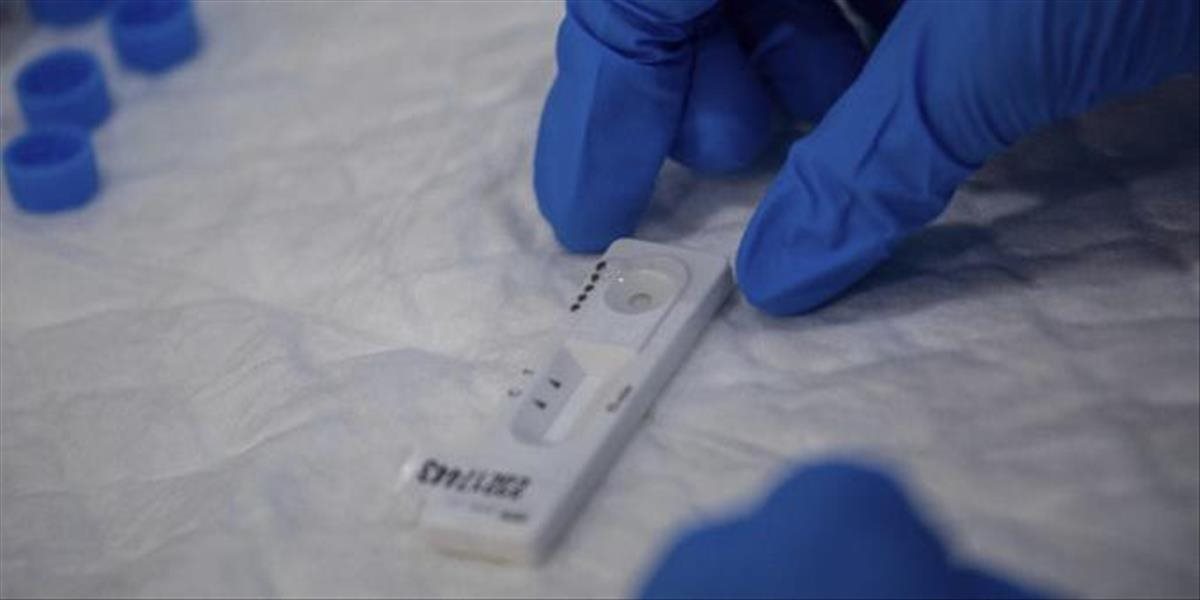 Pozrite si zoznam nových odberových miest na Slovensku, kam sa môžete prísť bezplatne otestovať