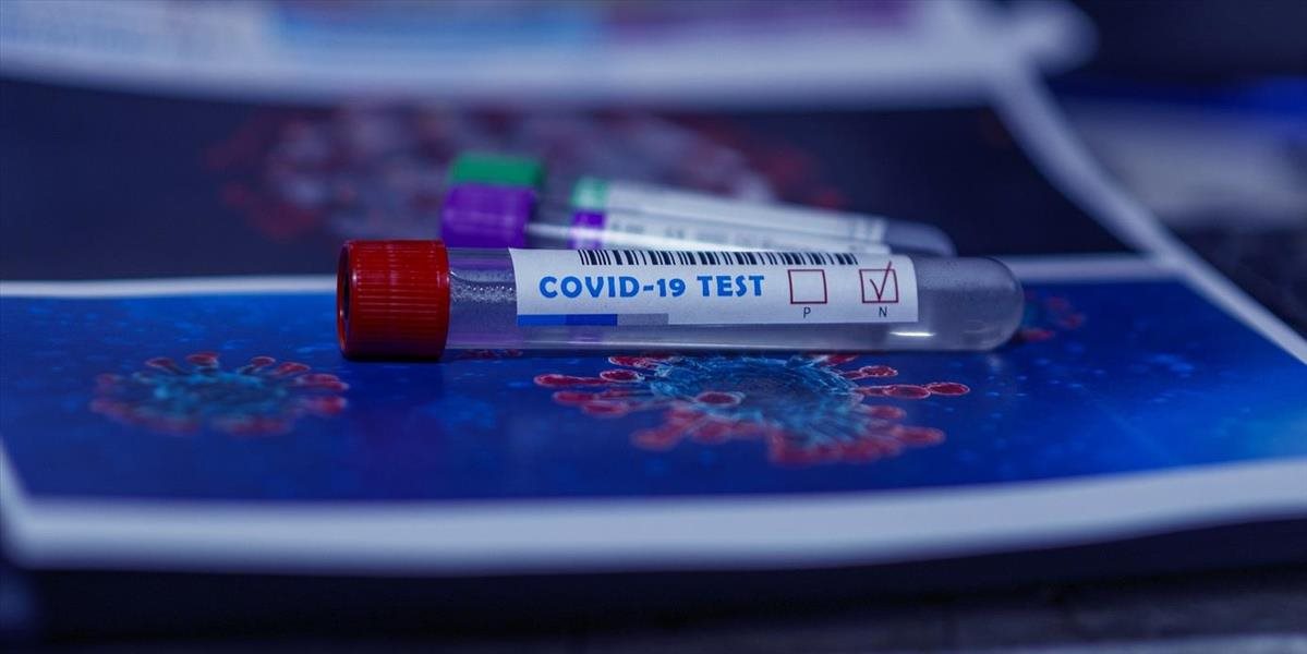 Negatívny PCR test, alebo karanténu zavádza už aj Srbsko
