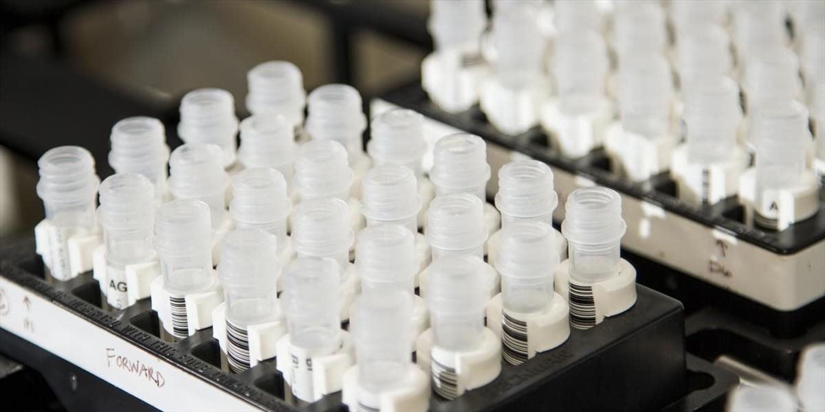 Testovanie výplachom ústnej dutiny si pochvaľujú školy aj žiaci