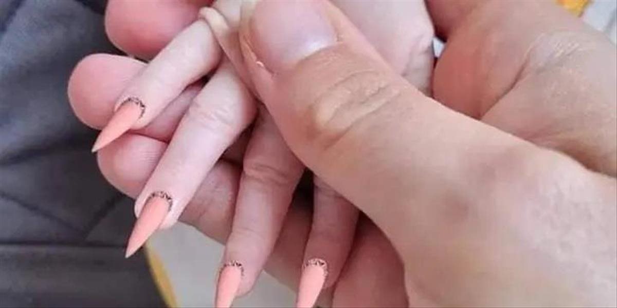 Šialená mamička urobila svojmu bábätku nebezpečnú manikúru