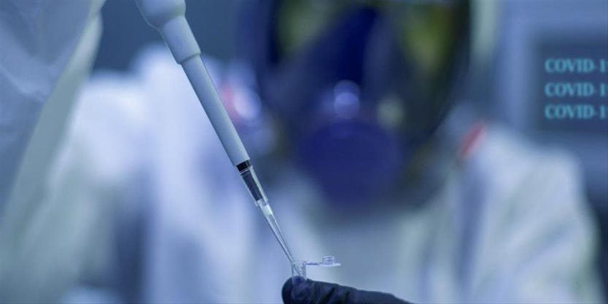 Nemecká vakcína CureVac by mohla dostať zelenú o pár mesiacov, firma očkovaciu látku už začala vo veľkom vyrábať