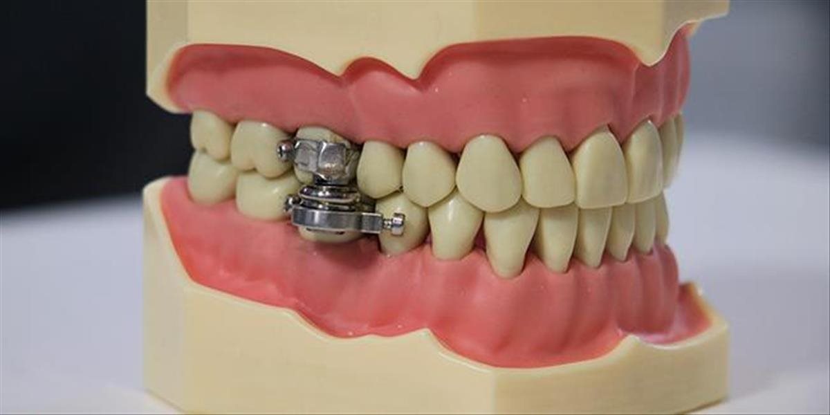 Radikálne zariadenie na chudnutie, ktoré vás doslova prinúti držať jazyk za zubami
