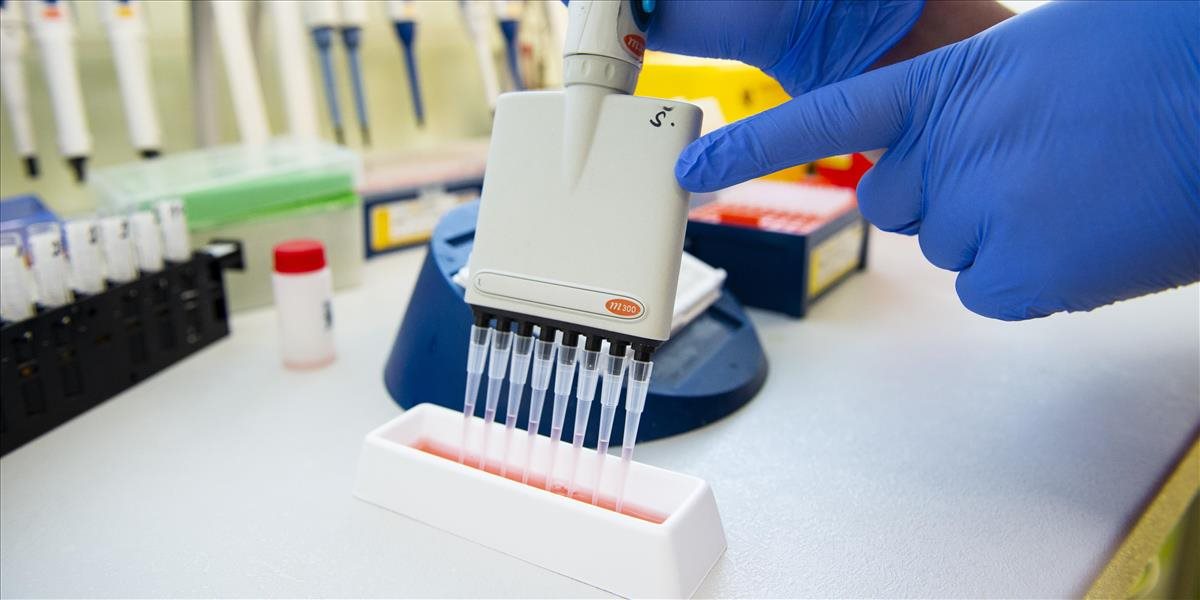 Vedci z ČR vyvinuli test na určenie protilátok proti COVID-19. Má niekoľko výhod