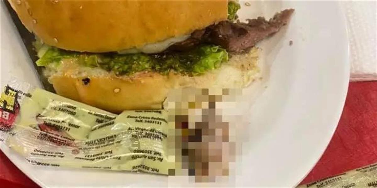 VIDEO: Žena jedla hamburger a zistila, že prežúva zvyšky ľudského prsta!