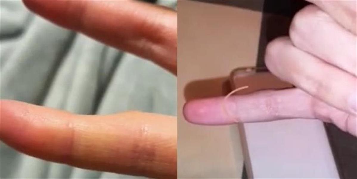 Ľudia na celom svete si kontrolujú malíčky! Pozrite sa, či sa to stalo aj vám!