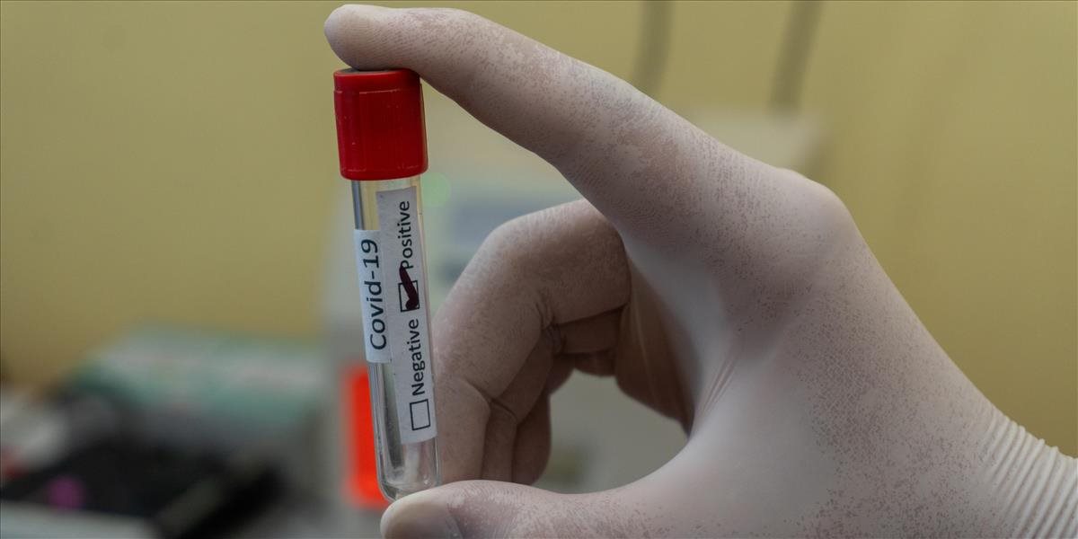 V Belgicku potvrdili prvý prípad nového variantu koronavírusu, ktorý sa šíri v Afrike