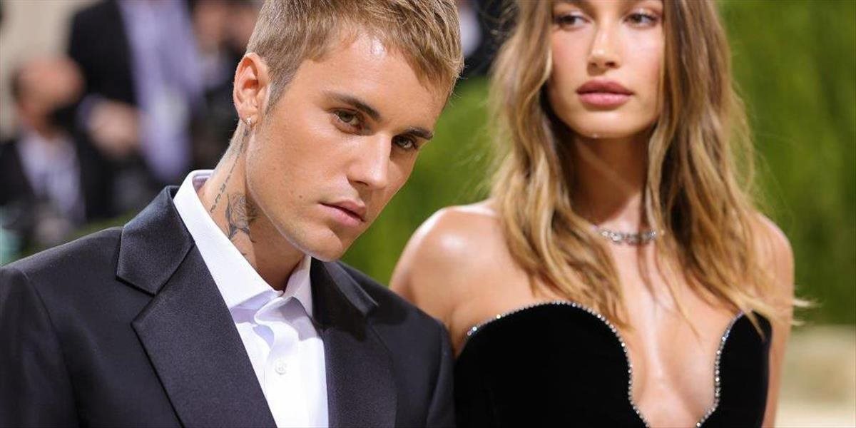 Hailey Bieber skončila v nemocnici, mala príznaky podobné mŕtvici