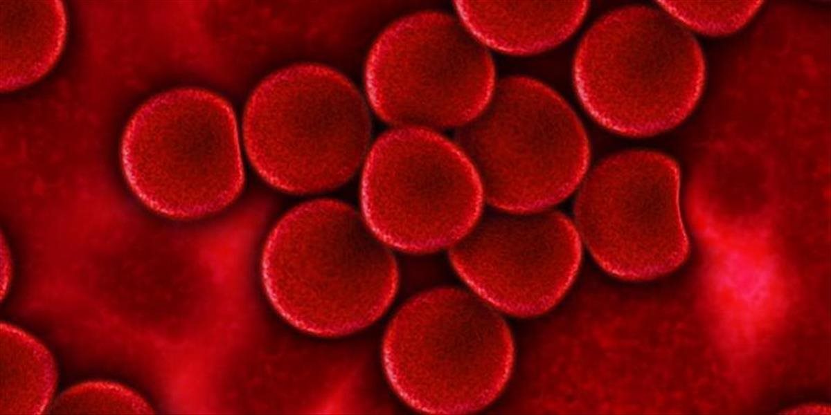 Lepšie prognózy pre slovenských pacientov s rakovinou krvi