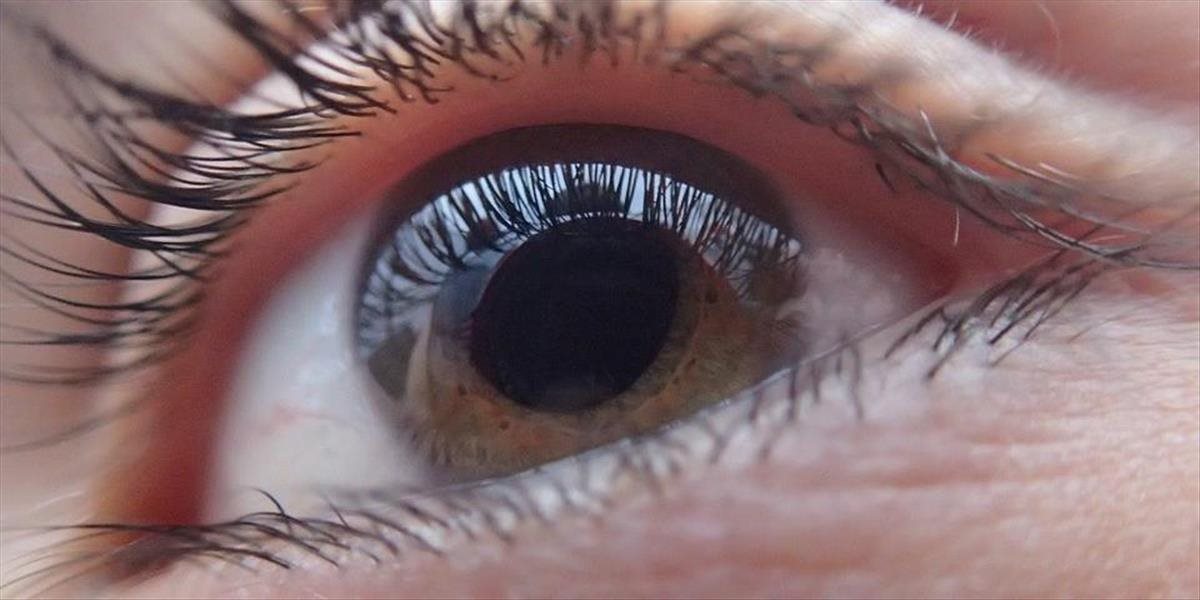 Pravidelné očné prehliadky sú jedinou prevenciou rozvoja zeleného zákalu