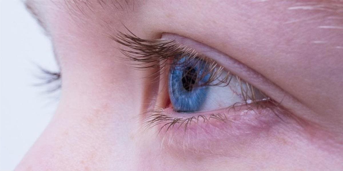 Pri syndróme suchého oka pomôžu umelé slzy, ale aj režimové opatrenia