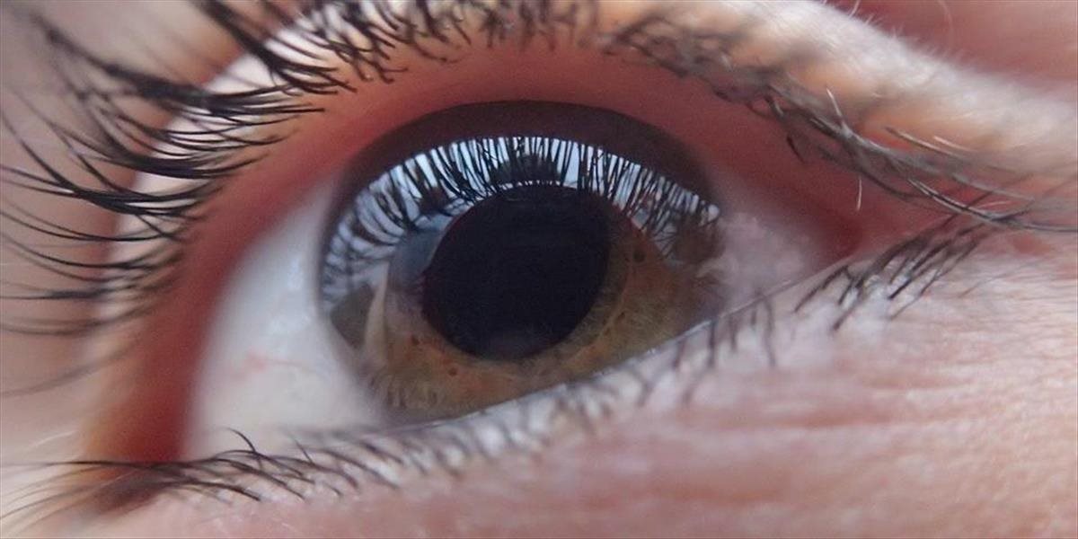 Oční lekári pacientom v roku 2021 najčastejšie diagnostikovali zelený zákal